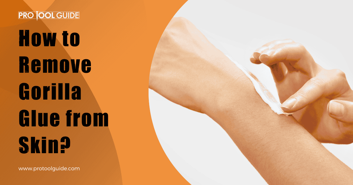 How to Remove Gorilla Glue from Skin